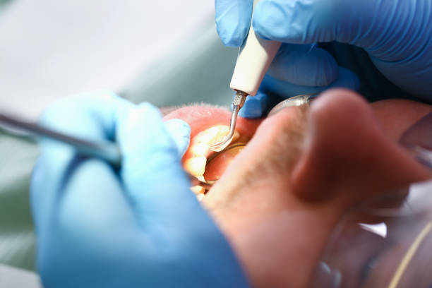 Best Emergency Treatment for Toothache in Flemington, NJ